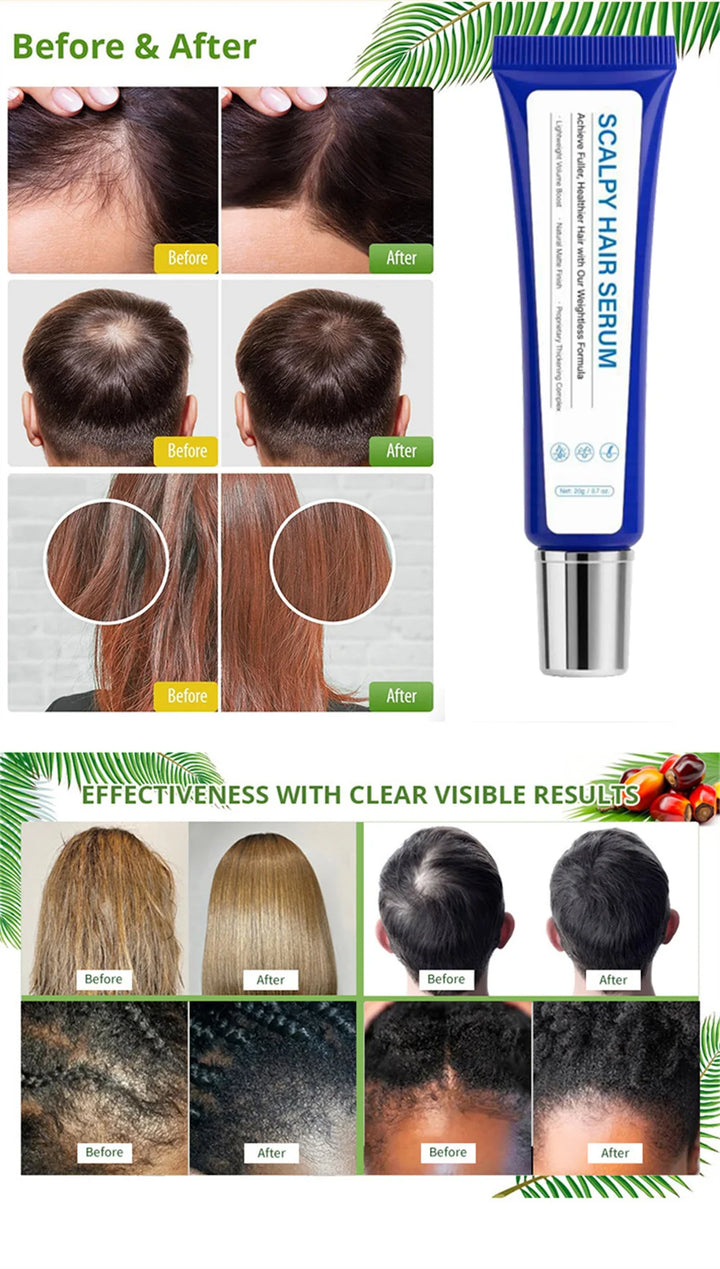 Fast Hair Growth Serum Hair Regrowth Essential Oil Anti Hair Loss Repair Damaged Scalp Women Men Anti Baldness Hair Growth Care
