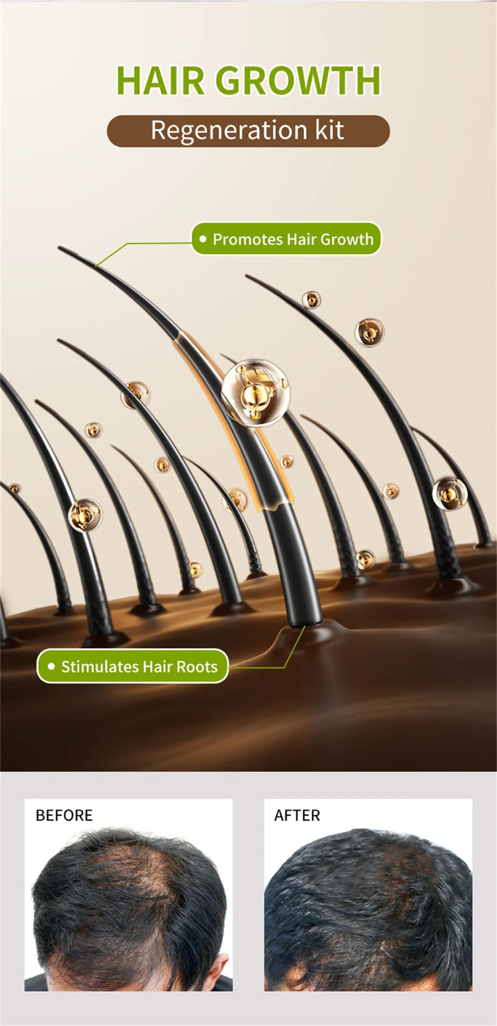Fast Hair Growth Serum Hair Regrowth Essential Oil Anti Hair Loss Repair Damaged Scalp Women Men Anti Baldness Hair Growth Care