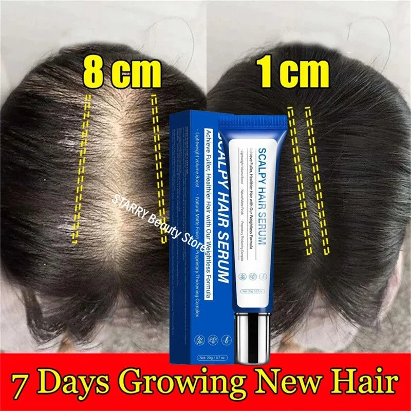 Fast Hair Growth Serum Hair Regrowth Essential Oil Anti Hair Loss Repair Damaged Scalp Women Men Anti Baldness Hair Growth Care