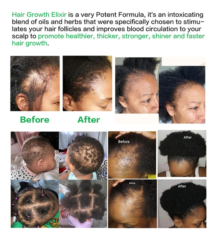 Fast Hair Growth Serum Hair Regrowth Essential Oil Anti Hair Loss Repair Damaged Scalp Women Men Anti Baldness Hair Growth Care
