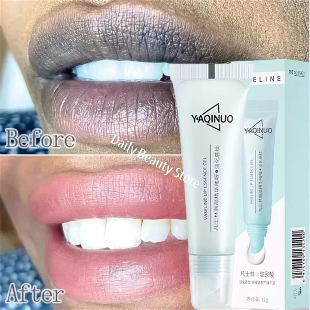 Remove Dark Lip Balm Fast Lightening Pink Lip Exfoliating Fade Lip Line Dead Skin Moisturizer Korean Care Products Beauty Health