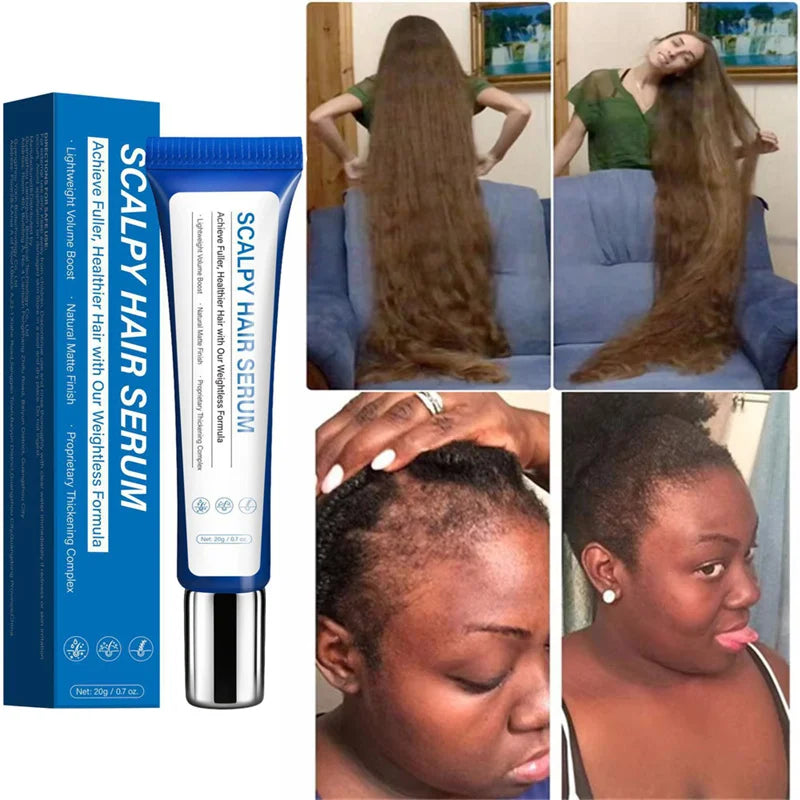 Fast Hair Growth Serum Hair Regrowth Essential Oil Anti Hair Loss Repair Damaged Scalp Women Men Anti Baldness Hair Growth Care